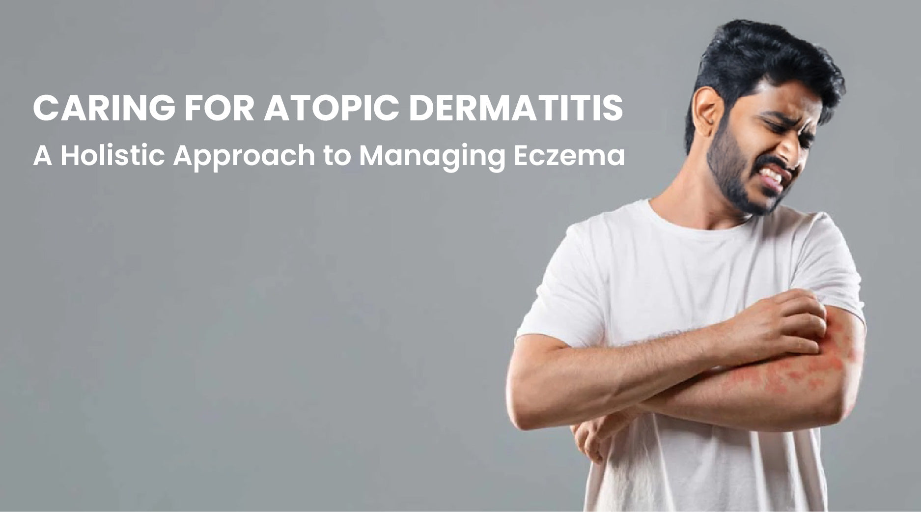 Caring for Atopic Dermatitis: A Holistic Approach to Managing Eczema